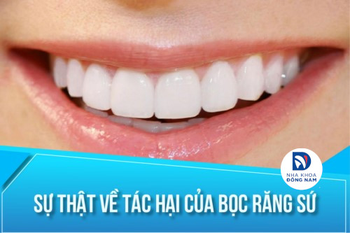 sự thật về tác hại của bọc răng sứ