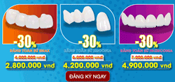 Khuyên mãi Bọc răng sứ nhân dịp 30 thang 4