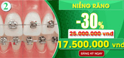 Khuyên mãi chỉnh nha niềng răng nhân dịp 30 thang 4
