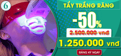 Khuyên mãi tây trắng răng nhân dịp 30 thang 4