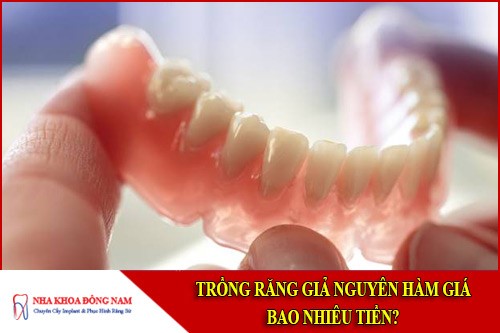trồng răng giả nguyên hàm giá bao nhiêu tiền