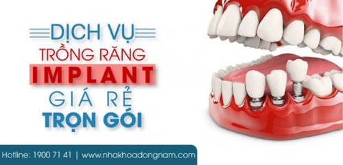 trồng răng implant giá rẻ