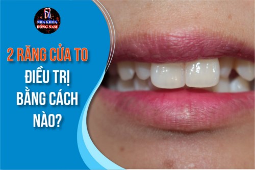2 răng cửa to điều trị bằng cách nào