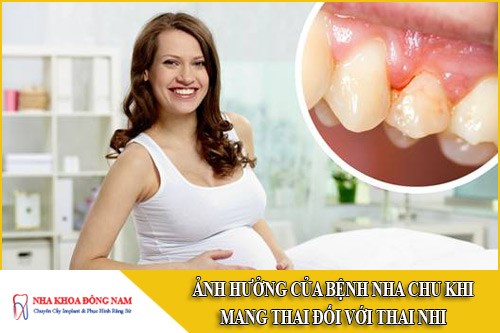 Ảnh hưởng của bệnh nha chu khi mang thai đối với thai nhi