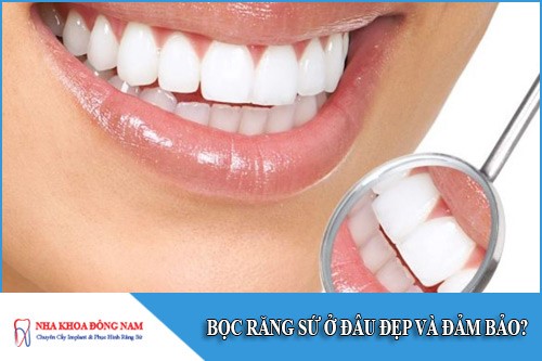 Bọc răng sứ ở đâu đẹp và đảm bảo