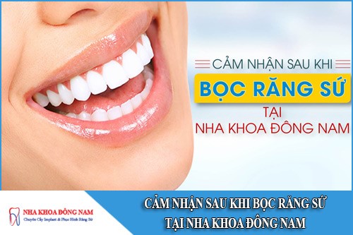 cảm nhận sau khi bọc răng sứ