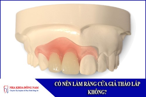 có nên làm răng cửa giả tháo lắp không