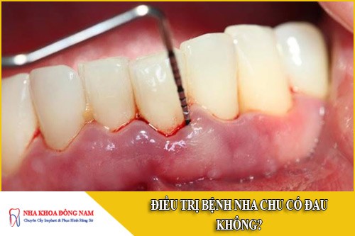 điều trị bệnh nha chu có đau không