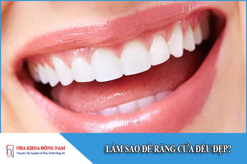 làm sao để răng cửa đều đẹp
