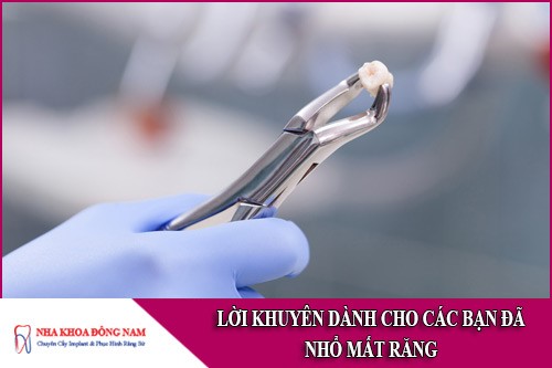 Lời khuyên dành cho các bạn đã Nhổ Mất Răng