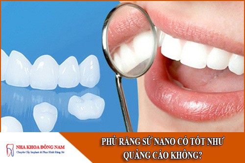 phủ răng sứ nano có tốt như quảng cáo không