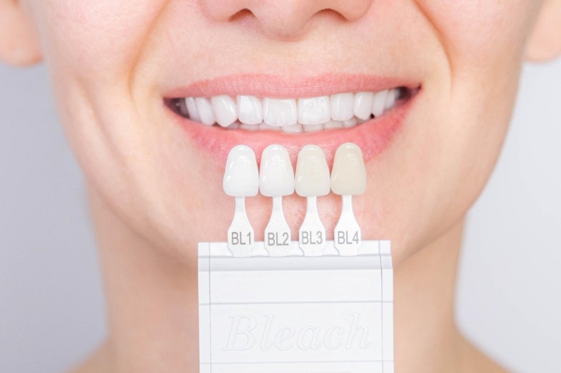 Tại sao bắt buộc phải bọc sứ 4 răng cửa mà không phải 2?