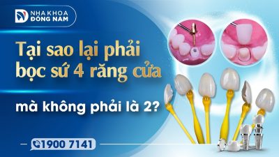 Tại sao lại phải bọc sứ 4 răng cửa mà không phải là 2?