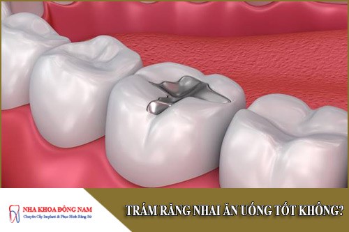 trám răng nhai ăn uống tốt không