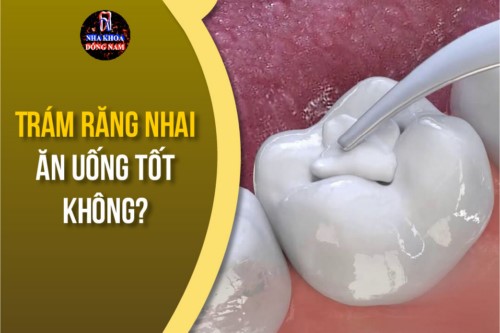 trám răng nhai ăn uống tốt không