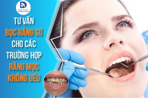 Tư vấn bọc răng sứ cho trường hợp răng mọc không đều
