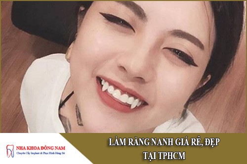 Làm RĂNG NANH giá rẻ, đẹp tại TPHCM