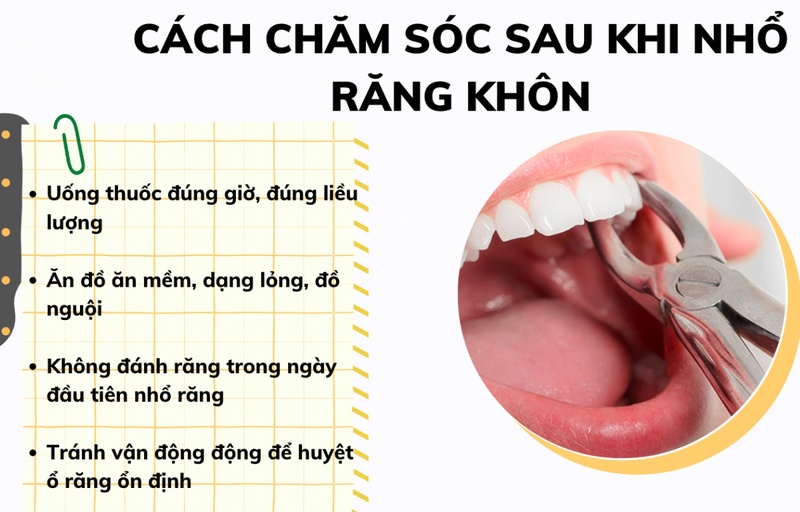Lưu ý chăm sóc sau khi nhổ răng khôn