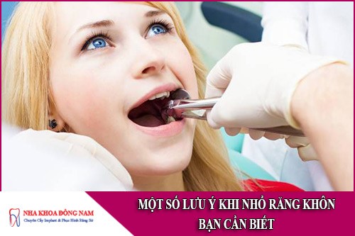 Một số lưu ý khi nhổ răng khôn bạn CẦN BIẾT