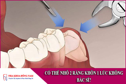 có thể nhổ 2 răng khôn 1 lúc không bác sĩ