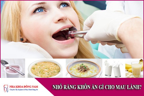 nhổ răng khôn ăn gì cho mau lành