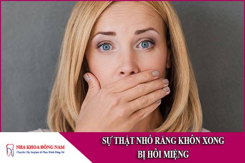 Sự thật việc nhổ răng khôn xong bị hôi miệng