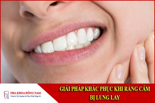 Giải pháp khắc phục khi RĂNG CẤM Bị Lung Lay