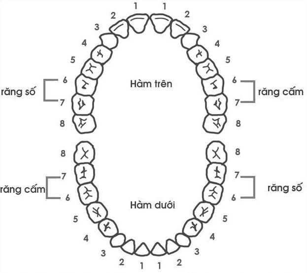 Răng cấm là răng số 6 và số 7 trên cung ham