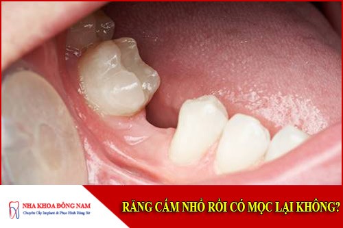 Răng cấm nhổ rồi có mọc lại không?