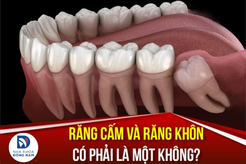 Răng cấm và răng khôn có phải là một không?