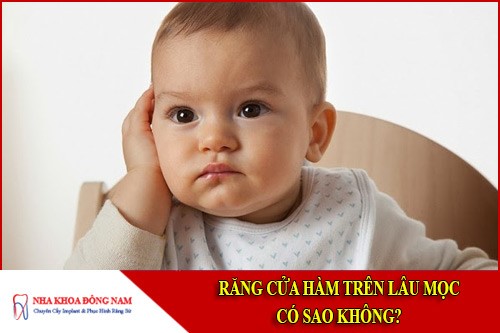 răng cửa hàm trên lâu mọc có sao không