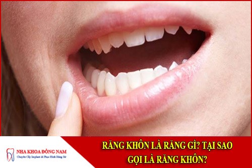 Răng khôn là răng gì? Tại sao gọi là răng khôn?