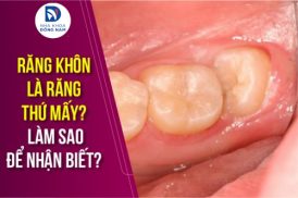 Răng khôn là răng thứ mấy? Làm sao để nhận biết?