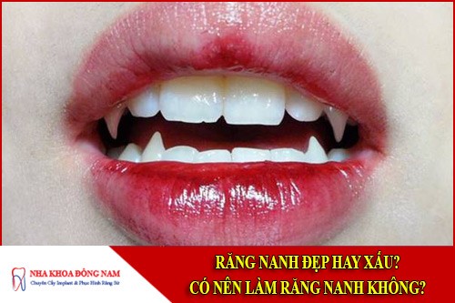 Răng nanh đẹp hay xấu? Có nên làm răng nanh không?
