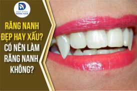 Răng nanh đẹp hay xấu? Có nên làm răng nanh không?