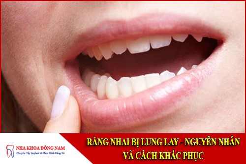 Răng nhai bị lung lay: Nguyên nhân và cách khắc phục