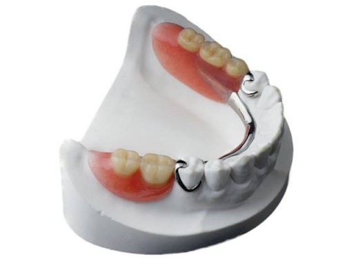 hàm tháo lắp cho răng nhai