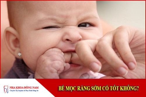 Bé mọc răng sớm có tốt không bác sĩ