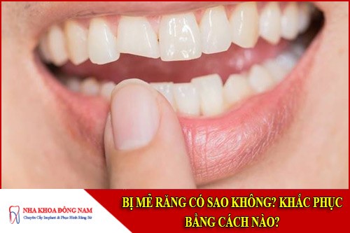 Bị mẻ răng có sao không? Khắc phục bằng cách nào?