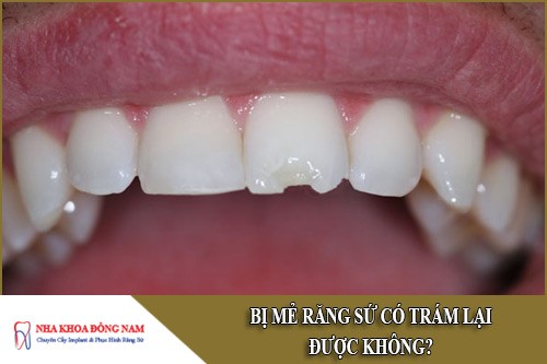 Bị mẻ răng sứ có trám lại được không?