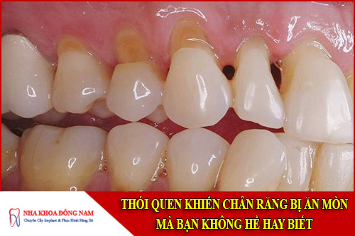 Thói quen khiến Chân Răng Bị Ăn Mòn mà bạn không hề hay biết