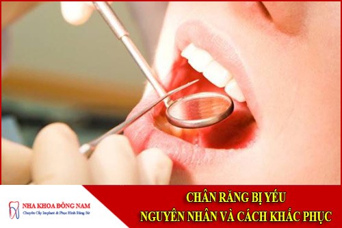 Chân răng bị yếu - Nguyên nhân và cách điều trị