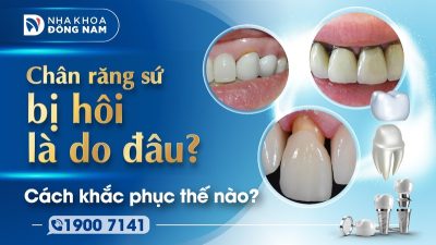 Chân răng sứ bị hôi là do đâu? Cách khắc phục thế nào?