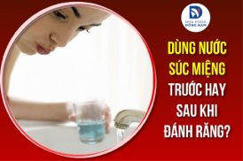dùng nước súc miệng trước hay sau khi đánh răng
