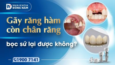 Gãy răng hàm còn chân răng bọc sứ lại được không?