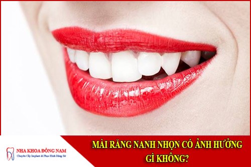 Mài răng nanh nhọn có ảnh hưởng gì không