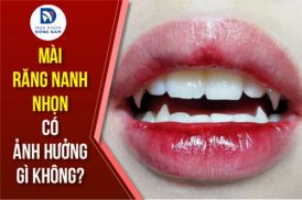 Mài răng nanh nhọn có ảnh hưởng gì không