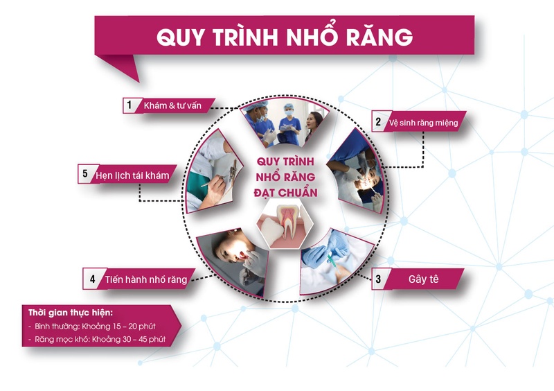 Quy trình nhổ răng khôn an toàn, hiệu quả