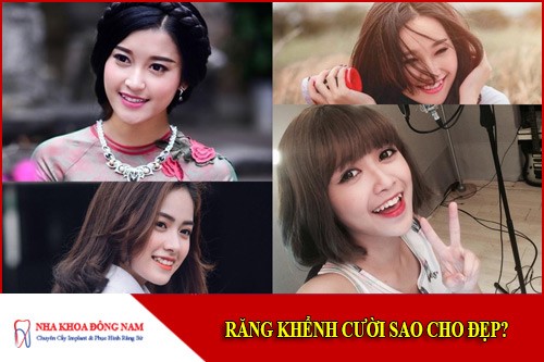 răng khểnh cười sao cho đẹp
