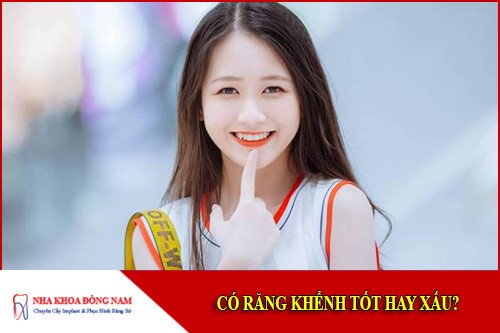 có răng khểnh tốt hay xấu